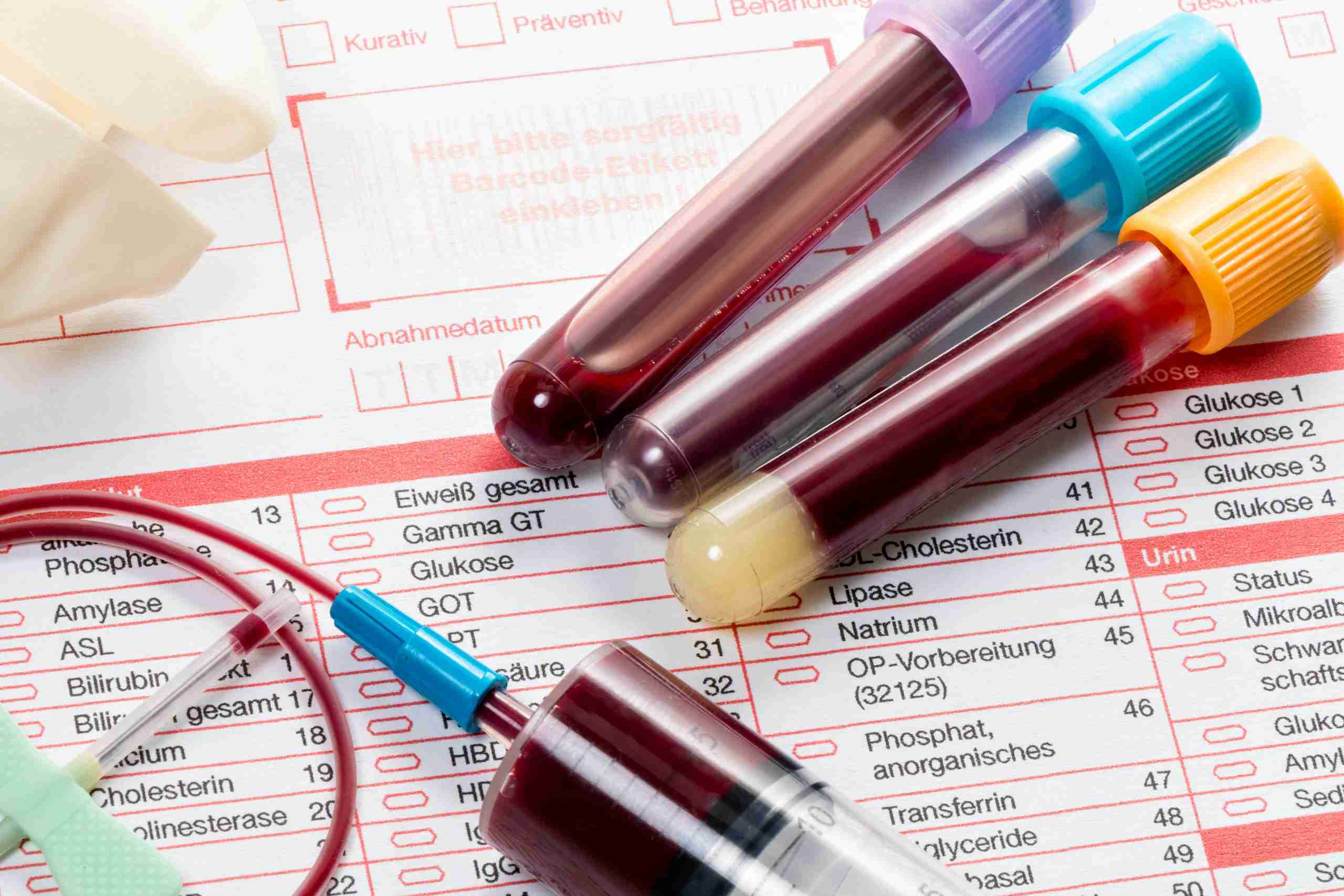 What Does A General Blood Test Test For